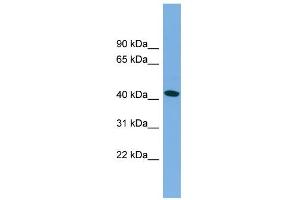 WB Suggested Anti-MAPT Antibody Titration:  0.