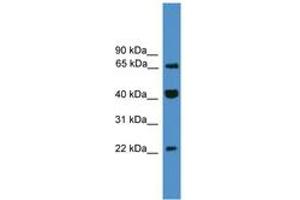 Image no. 1 for anti-Transcription Elongation Factor A (SII)-Like 6 (TCEAL6) (C-Term) antibody (ABIN6745441)