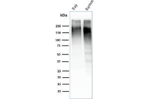 Western Blot Analysis of Raji and Ramos cell lysate using Ki67-Monospecific Mouse Monoclonal Antibody (MKI67/2462).