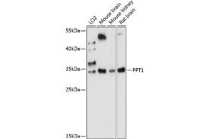 Western blot analysis of extracts of various cell lines, using PPT1 antibody (ABIN7269164) at 1:1000 dilution. (PPT1 antibody  (AA 28-306))