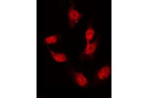 Immunofluorescence (fixed cells) (IF/ICC) image for anti-GATA Binding Protein 4 (GATA4) (pSer105) antibody (ABIN6256094)