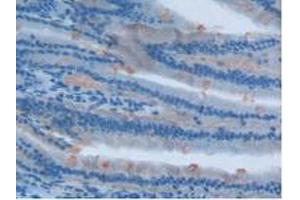 IHC-P analysis of Rat Intestine Tissue, with DAB staining. (Involucrin antibody  (AA 461-551))