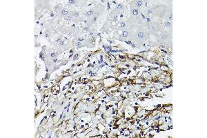Immunohistochemistry of paraffin-embedded human liver using CD90/Thy1 Rabbit mAb (ABIN6129735, ABIN6148554, ABIN6148555 and ABIN7101405) at dilution of 1:100 (40x lens). (CD90 antibody)