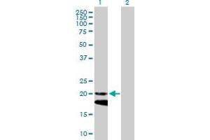 Western Blot analysis of IFNA4 expression in transfected 293T cell line by IFNA4 MaxPab polyclonal antibody. (IFNA4 antibody  (AA 1-189))