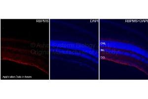 Immunohistochemistry (IHC) image for anti-RNA Binding Protein with Multiple Splicing (RBPMS) (N-Term) antibody (ABIN2778710)