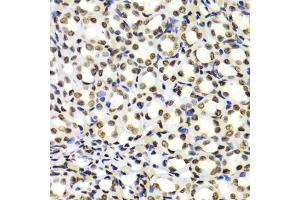 Immunohistochemistry of paraffin-embedded Rat kidney using Dimethyl-Histone H3-K4 antibody (ABIN5969803) at dilution of 1/100 (40x lens). (Histone 3 antibody  (H3K4me2))