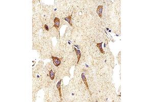 Immunohistochemical analysis of paraffin-embedded H. (Myosin antibody  (AA 654-668))