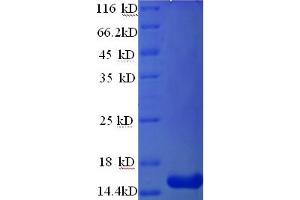 SDS-PAGE (SDS) image for Matrix Gla Protein (MGP) (AA 20-96) protein (His tag) (ABIN4974526) (MGP Protein (AA 20-96) (His tag))