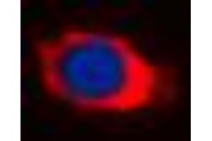 Immunofluorescent analysis of Cytochrome P450 27A1 staining in HepG2 cells. (CYP27A1 antibody  (Center))