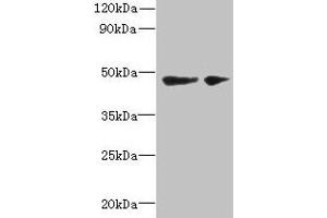 Western blot All lanes: SLC25A46 antibody at 6 μg/mL Lane 1: Mouse brain tissue Lane 2: Jurkat whole cell lysate Secondary Goat polyclonal to rabbit IgG at 1/10000 dilution Predicted band size: 47, 31, 38 kDa Observed band size: 47 kDa (SLC25A46 antibody  (AA 1-102))