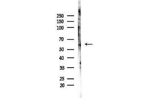 Western blot analysis of lysates from F10-LUC cells(LPS,4h treatment), using Phospho-Estrogen Receptor alpha (Ser106) Antibody at 1/1000 dilution.