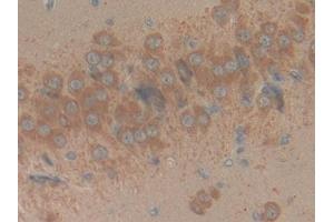 Detection of RPRM in Rat Brain Tissue using Polyclonal Antibody to Reprimo (RPRM) (Reprimo antibody  (AA 1-109))