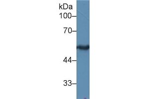 Western Blot; Sample: Rat Skin lysate; Primary Ab: 2µg/ml Rabbit Anti-Human KRT15 Antibody Second Ab: 0. (KRT15 antibody  (AA 274-399))