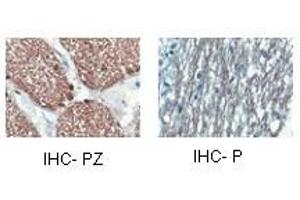 CNP antibody staining of oligodendrocyte lineage cells in the human optic nerve and/or spinal cord. (Cnpase antibody  (Middle Region))