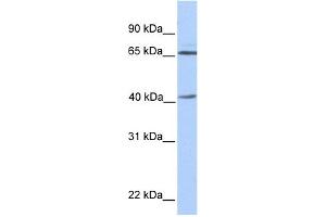 WB Suggested Anti-GLA Antibody Titration: 0. (GLA antibody  (N-Term))