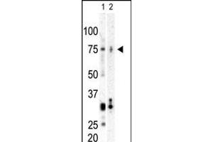 Western blot analysis of anti-CNK Pab in SK-BR3 cell lysate (Lane A) and mouse heart tissue lysate (Lane B) (PLK3 antibody  (C-Term))
