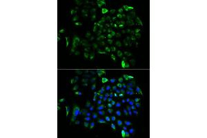 Immunofluorescence (IF) image for anti-Eukaryotic Translation Elongation Factor 1 beta 2 (EEF1B2) (AA 1-225) antibody (ABIN6139949)