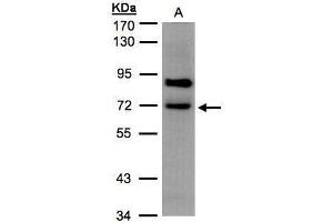 WB Image Sample(30 μg of whole cell lysate) A:293T 7. (SLC20A2 antibody)