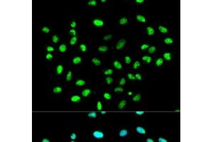 Immunofluorescence analysis of MCF-7 cells using HNRNPK Polyclonal Antibody (HNRNPK antibody)