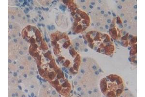 #VALUE! (CHI3L1 antibody  (AA 117-364))