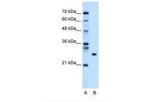 Image no. 1 for anti-RNA Binding Protein with Multiple Splicing (RBPMS) (AA 43-92) antibody (ABIN320529) (RBPMS antibody  (AA 43-92))