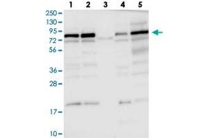 Western blot analysis of Lane 1: RT-4, Lane 2: U-251 MG, Lane 3: Human Plasma, Lane 4: Liver, Lane 5: Tonsil with DENND1C polyclonal antibody  at 1:100-1:250 dilution.