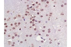 Paraformaldehyde-fixed, paraffin embedded mouse brain, Antigen retrieval by boiling in sodium citrate buffer (pH6) for 15min, Block endogenous peroxidase by 3% hydrogen peroxide for 30 minutes,  Blocking buffer (normal goat serum) at 37°C for 20min, Antibody incubation with TPX2 Polyclonal Antibody at 1:400 overnight at 4°C, followed by a conjugated secondary and DAB staining. (TPX2 antibody  (AA 551-650))