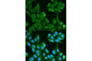 Immunofluorescence analysis of HeLa cell using FABP4 antibody.