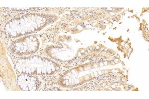 Detection of SMOX in Human Colon Tissue using Polyclonal Antibody to Spermine Oxidase (SMOX) (SMOX antibody  (AA 1-165))
