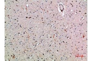 Immunohistochemical analysis of paraffin-embedded human-brain, antibody was diluted at 1:200 (CLEC4A antibody  (AA 161-210))
