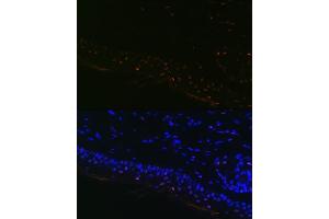 Immunofluorescence analysis of Mouse tail and ear using MITF Rabbit mAb (ABIN7268511) at dilution of 1:100 (40x lens). (MITF antibody)