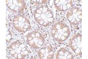 Immunohistochemistry of TEM2 in human colon tissue with this product at 2. (RASD2 antibody  (C-Term))