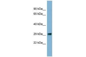 PRKRIP1 antibody used at 1 ug/ml to detect target protein. (PRKRIP1 antibody)
