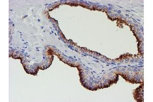 Image no. 1 for anti-Myocyte Enhancer Factor 2C (MEF2C) antibody (ABIN1499365) (MEF2C antibody)