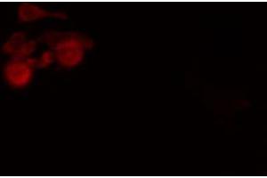 ABIN6274244 staining Hela cells by IF/ICC. (SOX6 antibody  (N-Term))