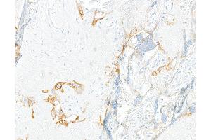 Immunohistochemistry (IHC) image for anti-Oxidized Low Density Lipoprotein (Lectin-Like) Receptor 1 (OLR1) (AA 61-273) antibody (ABIN7795657)