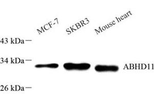 Western blot analysis of ABHD11 (ABIN7072873) at dilution of 1: 1000