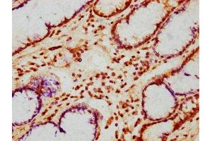 PHLDB1 antibody  (AA 233-423)