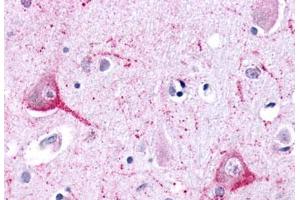Anti-LPHN2 antibody  ABIN1049024 IHC staining of human brain, neurons and glia. (LPHN2 antibody  (N-Term))