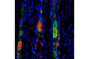 IF on rat trigeminal using Mouse monoclonal antibody to rat p75NTR (ABIN350707) at a concentration of 10 µg/ml (green), Rabbit antibody to internal part of cFos (c-fos): whole serum (ABIN350207) at 1 : 500 dilution and DAPI counterstained appearing in blue. (NGFR antibody)