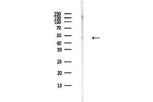 Western blot analysis of lysates from MCF7 cells(heat-shock,45 min treatment), using Phospho-IRF2 (Ser225) Antibody at 1/1000 dilution.