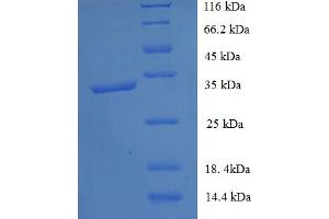 Transmembrane Protein 44 (TMEM44) (partial) protein (His-SUMO Tag)