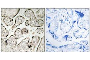 Immunohistochemistry analysis of paraffin-embedded human placenta tissue using GIMAP5 antibody. (GIMAP5 antibody  (C-Term))