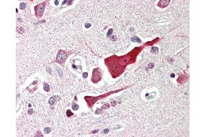 Anti-BCL2L10 / BCL-B antibody IHC of human brain, cortex. (BCL2L10 antibody  (N-Term))