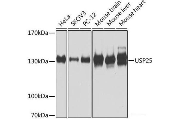 USP25 抗体