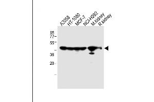 All lanes : Anti-P14 Antibody (N-term) at 1:2000 dilution Lane 1:  whole cell lysate Lane 2: HT-1080 whole cell lysate Lane 3: MCF-7 whole cell lysate Lane 4: NCI- whole cell lysate Lane 5: Mouse kidney lysate Lane 5: Rat kidney lysate Lysates/proteins at 20 μg per lane. (MMP14 antibody  (N-Term))