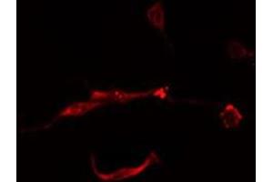ABIN6277890 staining  Hela cells by IF/ICC.