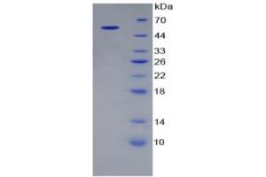 SDS-PAGE of Protein Standard from the Kit  (Highly purified E. (ALT ELISA Kit)