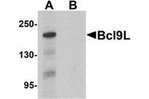 Western blot analysis of Bcl9L in HeLa cell lysate with Bcl9L antibody at 1 μg/ml in (A) the absence and (B) the presence of blocking peptide.