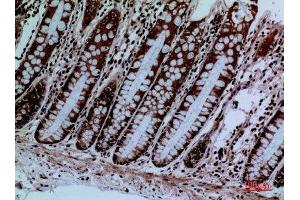 Immunohistochemistry (IHC) analysis of paraffin-embedded Human Colon, antibody was diluted at 1:100. (PROC antibody  (Internal Region))